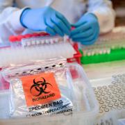 13 more coronavirus cases diagnosed in Somerset
